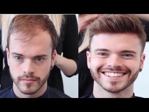 Read more about the article Hair Replacement Innovations Changing the Beauty Industry