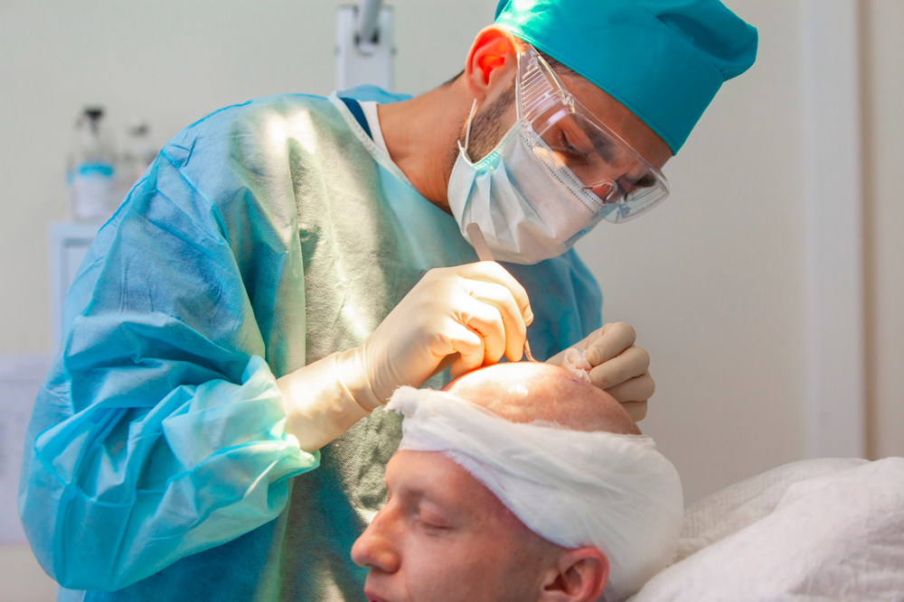 You are currently viewing Who Is the Ideal Candidate for Hair Transplant Surgery?