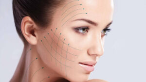 Read more about the article Thread Lift for Facial Contouring Without Surgery