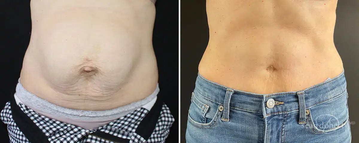 You are currently viewing Beyond the Operating Room: Why a Plastic Surgery Recovery Nurse is Essential for Your Healing Journey