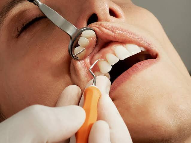 Read more about the article Signs You May Need Gum Surgery for Better Oral Health